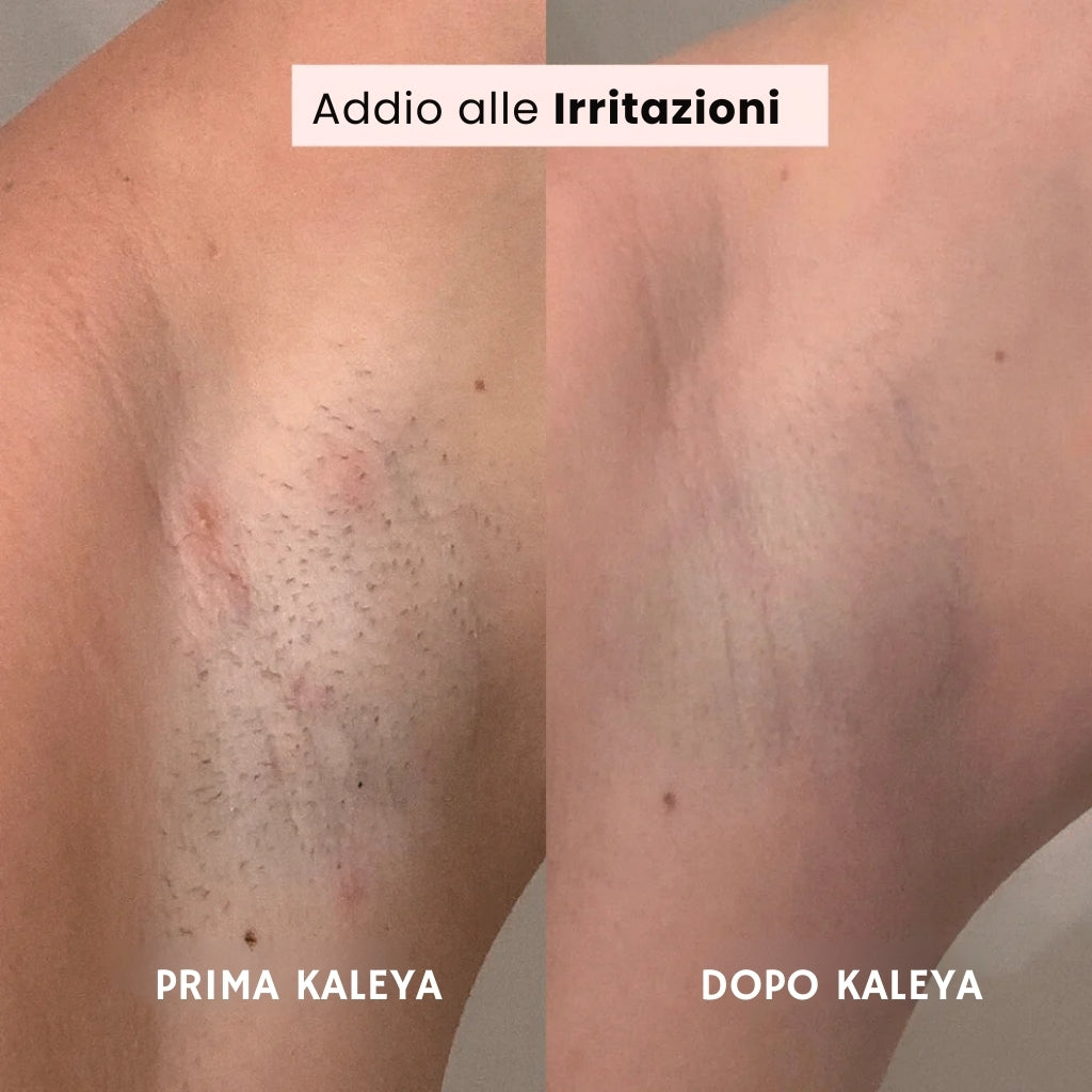 Rasoio KALEYA®